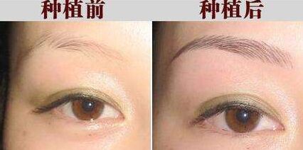 没有眉毛怎么办吃什么长出来,没有眉毛怎么办文案