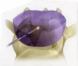 多年的胸闷气短啥原因,多年胸痛的原因和症状