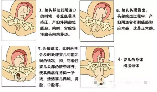 生娃前的几个步骤,快速生娃小技巧演练