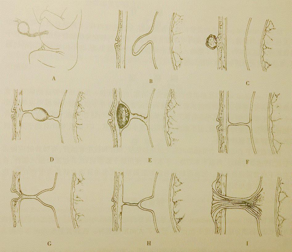 婴儿的脐部是什么东西,新生儿父母关注事项
