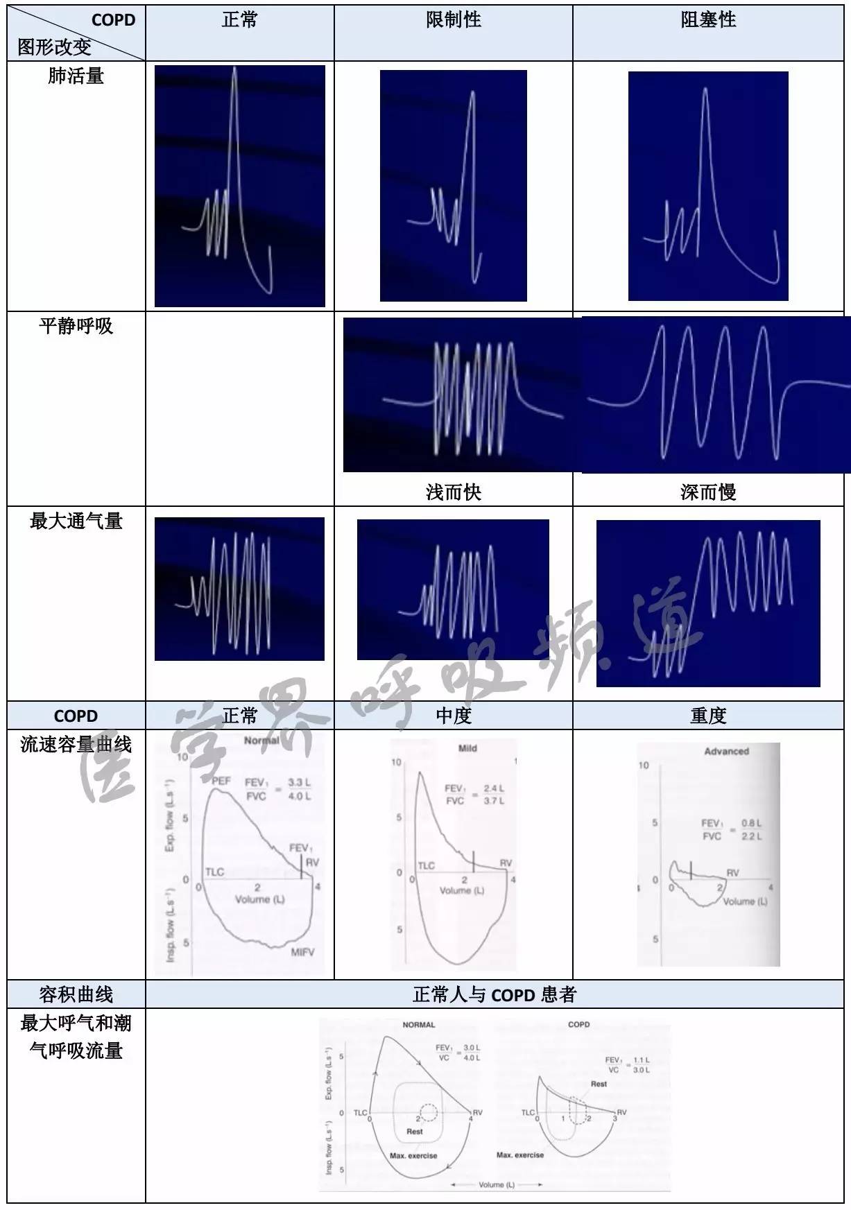 copd诊断用药,copd诊断最重要的检查