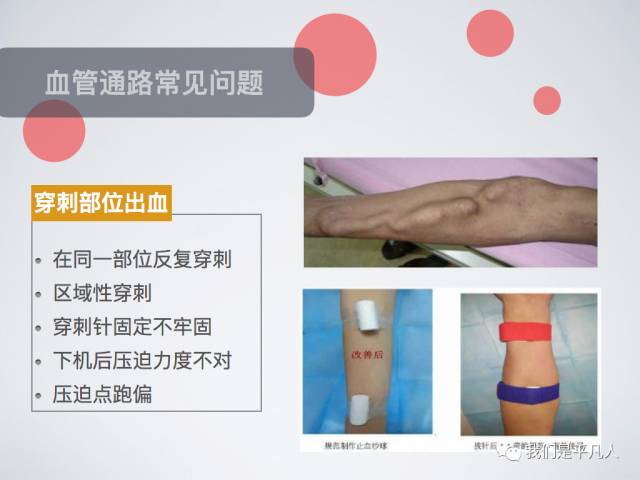 血透净化标准操作规程,血透护理科普怎么完成