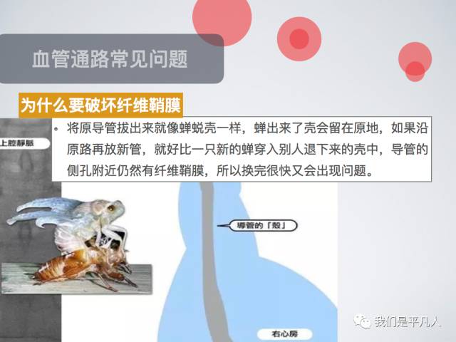 血透净化标准操作规程,血透护理科普怎么完成