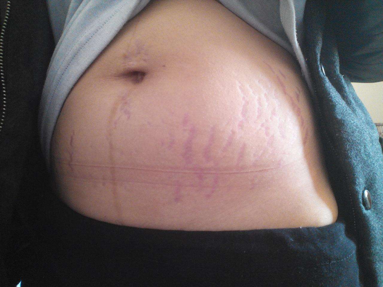 产后妈妈的心酸和尴尬,产后遭遇的尴尬和痛苦