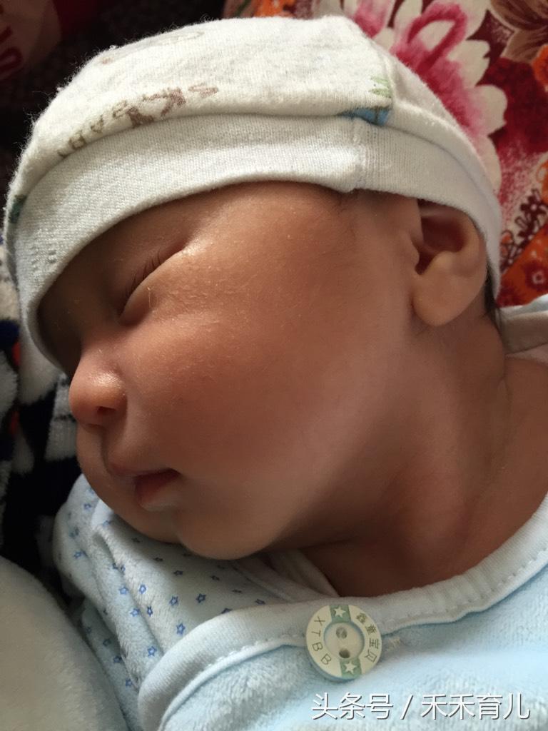 粗心妈妈使孩子胳膊脱位,斜颈宝宝歪头