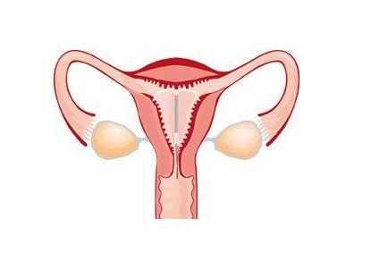 上环取环的相关要点,上环取环你了解多少呢