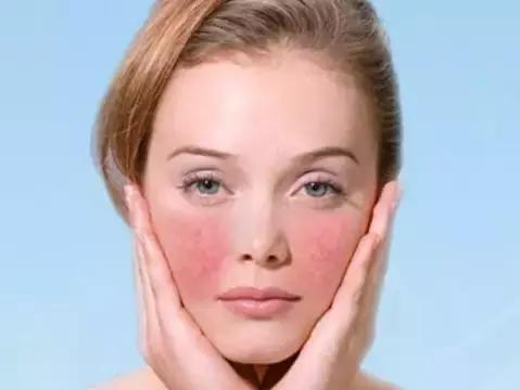 蒸脸器用多了皮肤有没有伤害,蒸脸器用多了会不会有什么副作用