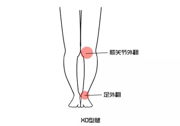 腿型不好看穿短裙怎么办,腿型不好看怎么练