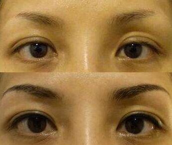 没有眉毛怎么办吃什么长出来,没有眉毛怎么办文案