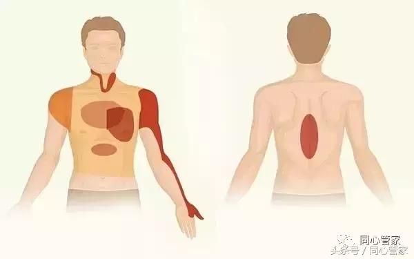 胸痛可能有哪些伴随症状,胸痛肋痛预示着三种疾病
