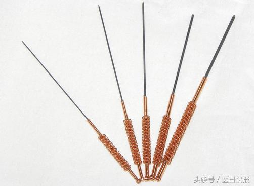 挑治疗法效果如何,民间速效挑点疗法