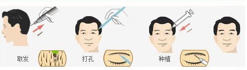 没有眉毛怎么办吃什么长出来,没有眉毛怎么办文案