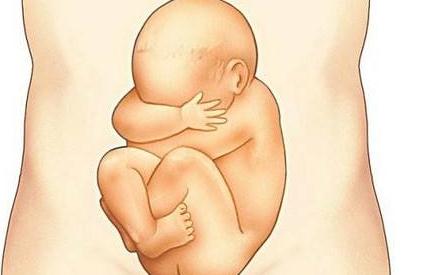 遇到这种胎动频繁要关注可能是胎儿出事了