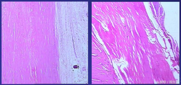 感染科可以治肝腹水吗,腹水被传染了怎么办