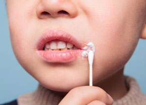 烫伤后的白癜风能治好吗,鳗鱼油膏能治好白癜风吗