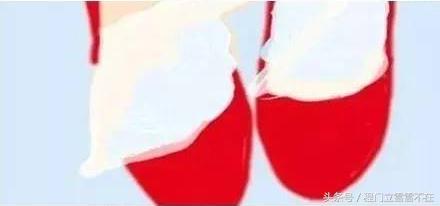 篮球鞋后跟磨脚处理4种方法,男士鞋磨脚后跟最简单的方法