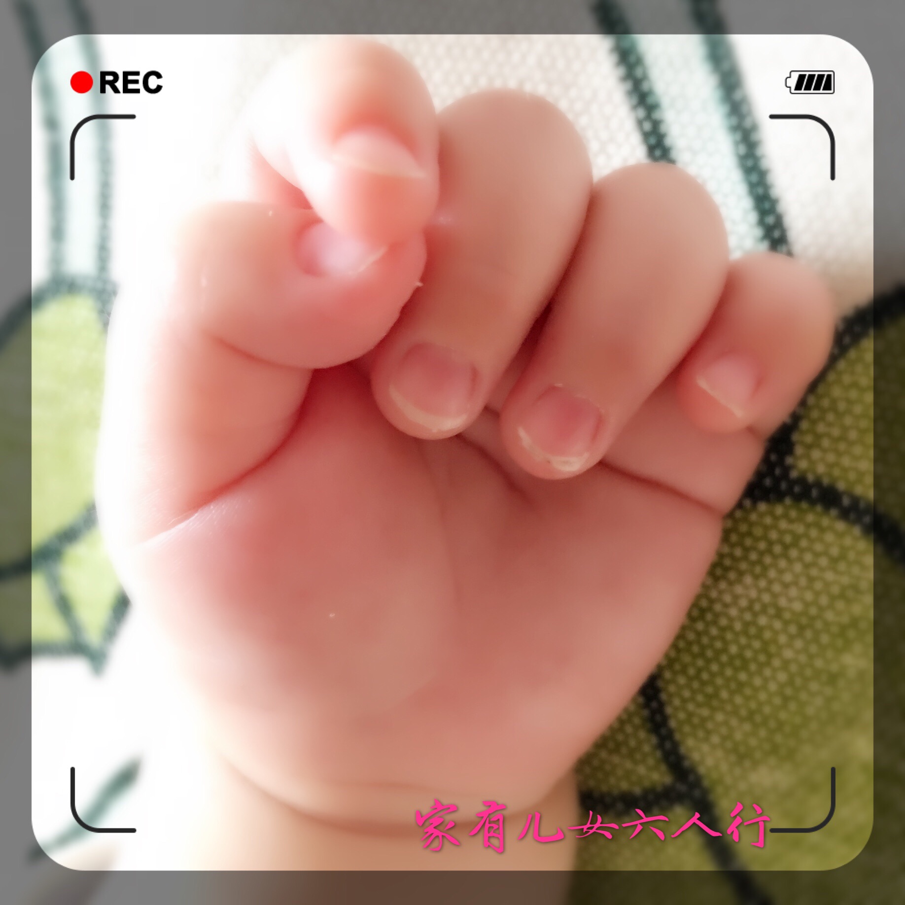 生孩子顺产转剖腹产全记录,我的生产经历