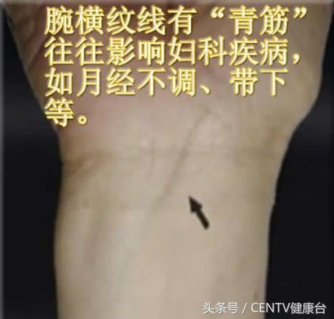 健身一段时间手背青筋明显了,健身乳房上边青筋明显是怎么回事