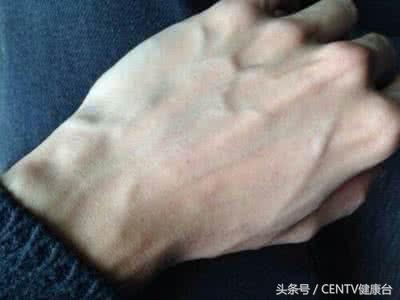 健身一段时间手背青筋明显了,健身乳房上边青筋明显是怎么回事