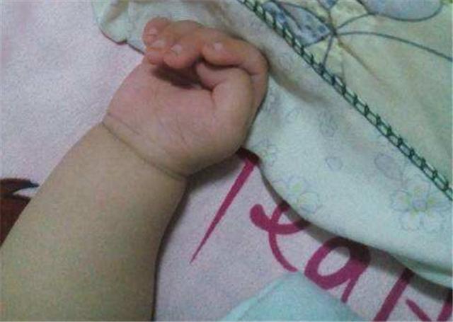 宝宝一个月拇指内扣是脑瘫嘛,宝宝拇指内扣是不是大脑受损