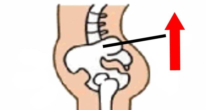 原来身体里面有个“盆儿”他到底有多重要呢？