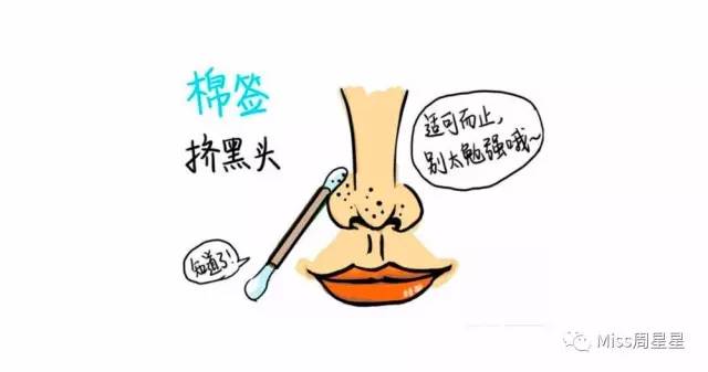 涓嶈姳閽辫繕鏈夋晥鐨勫幓榛戝ご鏂规硶get,娓╁拰楂樻晥鍘婚粦澶寸殑鏂规硶