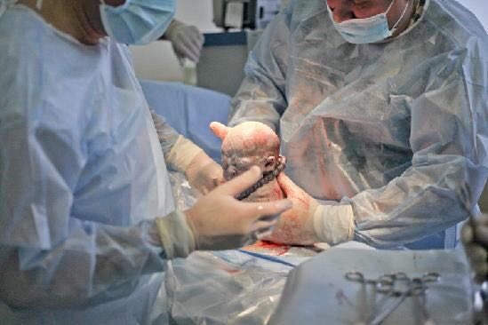 直击剖腹产全过程，看一次震撼一次心灵各位宝爸请珍惜