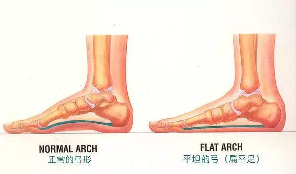足弓和脚后跟痛怎么回事,长期走路脚掌痛鞋垫软还是硬