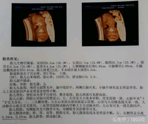 胎宝宝总是踢膀胱是怎么回事,胎宝宝踢妈妈膀胱会尿急么