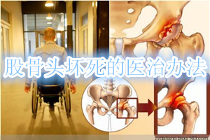股骨头坏死治疗最好的办法,股骨头坏死有什么好的治疗方法