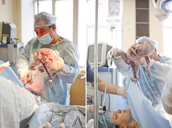 直击剖腹产全过程，看一次震撼一次心灵各位宝爸请珍惜