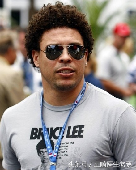 盘点整过牙的球星,还记得这些日益老去的球星吗