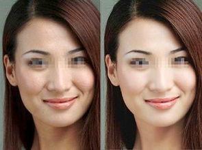 有效去死皮,正确去角质步骤