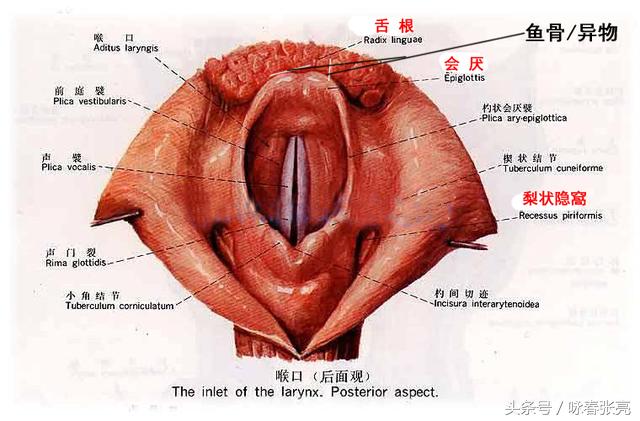 嗓子卡鱼刺医生找不到怎么办,鱼刺卡喉咙医生说吃药