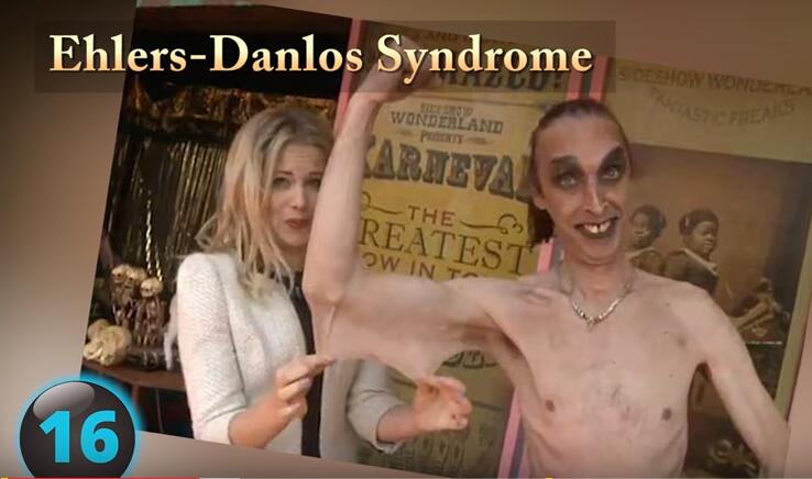 他们才是真正的超人，再大的挫折都挫不到他们，头不全又怎样