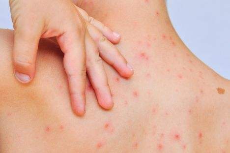 遗传性皮肤病的诊断思路,博美狗狗遗传性皮肤病怎么治疗