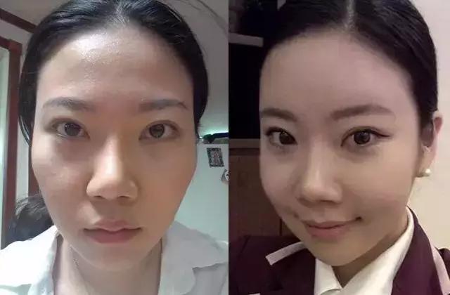 太阳穴凹陷的女人怎么破解,太阳穴凹陷的小妙招