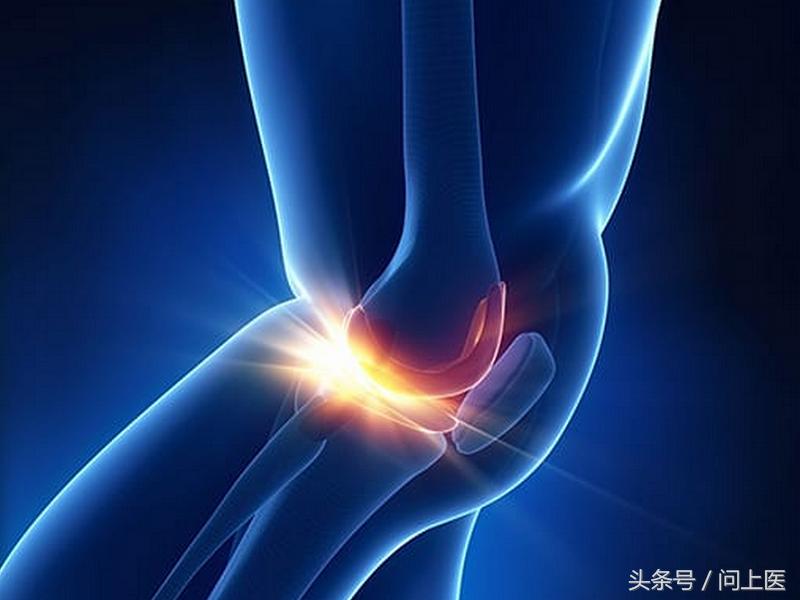 风湿性关节炎与类风湿关节炎区别,风湿关节炎与类风湿性关节炎区别