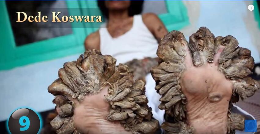 他们才是真正的超人，再大的挫折都挫不到他们，头不全又怎样