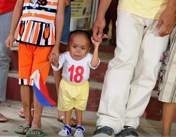 他们才是真正的超人，再大的挫折都挫不到他们，头不全又怎样