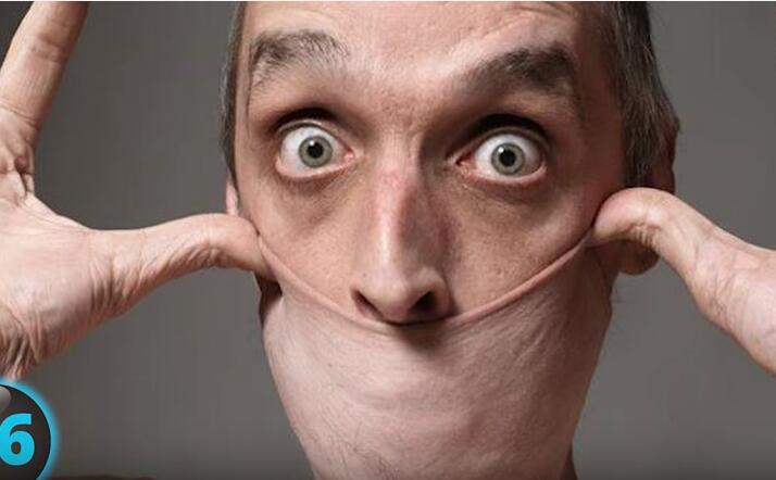 他们才是真正的超人，再大的挫折都挫不到他们，头不全又怎样