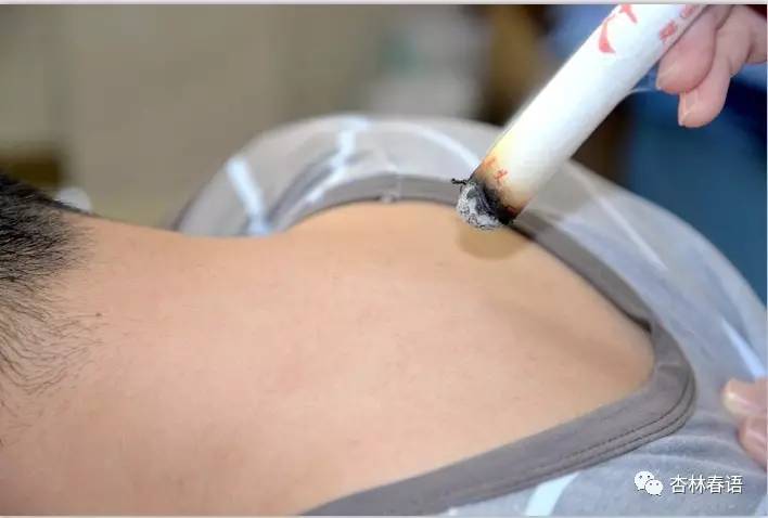 拔罐养生十大要穴,中医养生保健按摩拔罐顺序