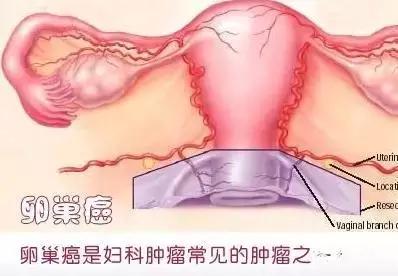 强生爽身粉致癌被判巨额赔付还有6种更危险日化产品你需要知道