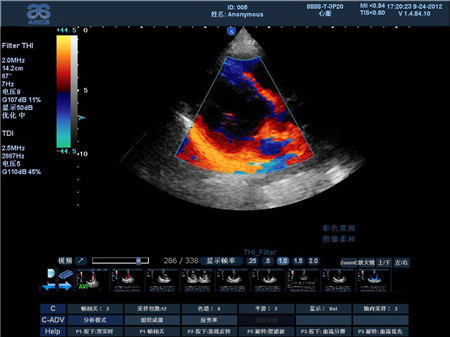 葡萄胎怎么检查出来呢,葡萄胎再次怀孕要不要检查卵子