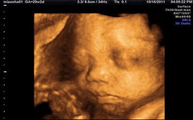 怀孕宝宝听见爸爸的声音,23天新生儿听懂爸爸说话的小视频