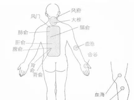 击退小疹子,四种方法帮你止痒