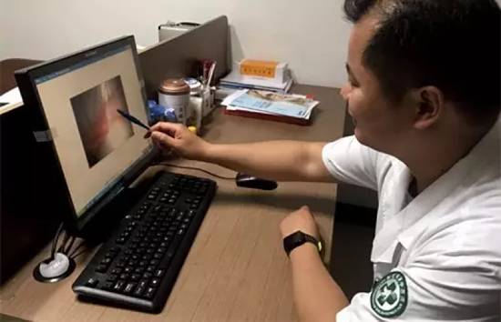 杭州一男子因眼睛奇痒就医，睫毛里竟爬出3条虫！