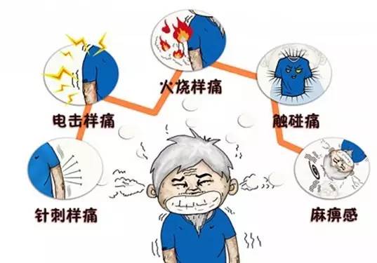 别把三叉神经痛误认为牙痛,别把三叉神经痛当牙痛