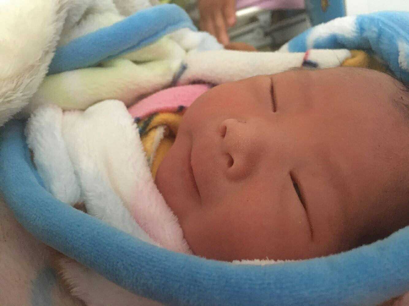 胎儿胎动频繁医生建议剖腹产,胎心异常剖腹产