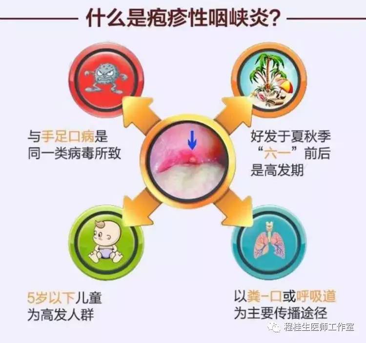 亮剑“疱疹性咽峡炎”,中医中药显良效！